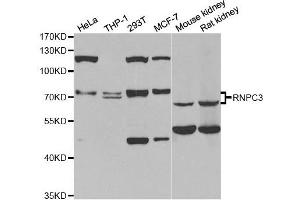 Western Blotting (WB) image for anti-RNA-Binding Region (RNP1, RRM) Containing 3 (RNPC3) antibody (ABIN1980349) (RNP Antikörper)