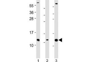 Western blot testing of human 1) Caco-2, 2) RMPI-8226 and 3) SH-SY5Y cell lysate with CKS2 antibody at 1:2000. (CKS2 Antikörper  (Regulatory Subunit 2))