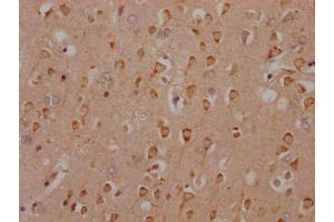 IHC image of ABIN7127314 diluted at 1:100 and staining in paraffin-embedded human brain tissue performed on a Leica BondTM system. (Rekombinanter HTR2C Antikörper)