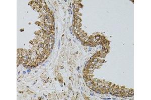 Immunohistochemistry of paraffin-embedded Human prostate using SELP Polyclonal Antibody at dilution of 1:100 (40x lens). (P-Selectin Antikörper)