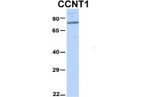 Host:  Rabbit  Target Name:  CCNT1  Sample Type:  Hela  Antibody Dilution:  1. (Cyclin T1 Antikörper  (N-Term))