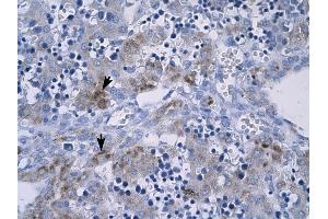 RGS9 antibody was used for immunohistochemistry at a concentration of 4-8 ug/ml to stain Hepatocytes (arrows) in Human Liver.