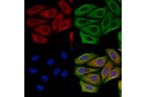 FUT6 Antibody staining Hela cells by IF/ICC. (FUT6 Antikörper  (N-Term))