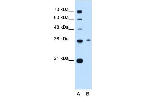 C11orf54 Antikörper  (C-Term)