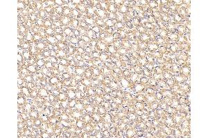 Immunohistochemistry analysis of paraffin-embedded Rat stomach cancer using CK-7 Monoclonal Antibody at dilution of 1:300. (Cytokeratin 7 Antikörper)