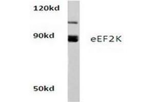 Image no. 1 for anti-Eukaryotic Elongation Factor-2 Kinase (EEF2K) antibody (ABIN265393) (EEF2K Antikörper)