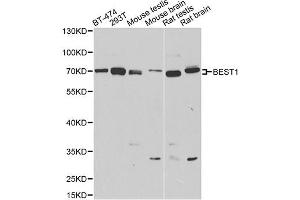 Western blot analysis of extracts of various cell lines, using BEST1 antibody (ABIN4903043) at 1:1000 dilution. (Bestrophin 1 Antikörper)