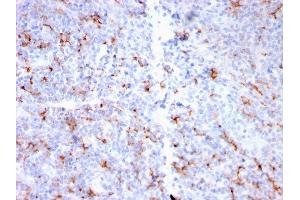 Formalin-fixed, paraffin-embedded human Tonsil stained with S100A8/A9 Complex Recombinant Rabbit Monoclonal Antibody (MAC3157R). (Rekombinanter S100A8 Antikörper)