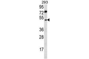 ABHD2 Antibody (Center) western blot analysis in 293 cell line lysates (35 µg/lane). (ABHD2 Antikörper  (Middle Region))