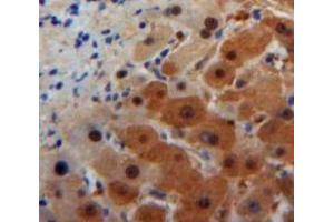 Used in DAB staining on fromalin fixed paraffin-embedded Liver tissue (ORM1 Antikörper  (AA 19-207))