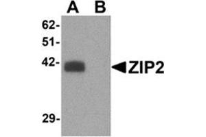 Western Blotting (WB) image for anti-Solute Carrier Family 39 (Zinc Transporter), Member 2 (Slc39a2) (N-Term) antibody (ABIN783797)