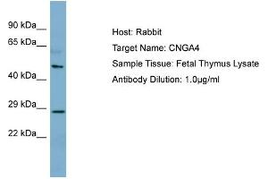 Host: Rabbit Target Name: CNGA4 Sample Type: Fetal Thymus lysates Antibody Dilution: 1.