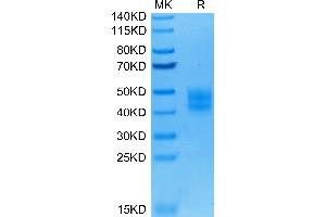 CD276 Protein (CD276) (AA 29-245) (His tag)