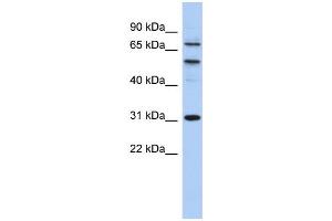 WB Suggested Anti-SSRP1 Antibody Titration: 0. (SSRP1 Antikörper  (Middle Region))