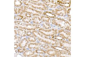 Immunohistochemistry of paraffin-embedded mouse kidney using NDUFB9 Rabbit mAb (ABIN7268815) at dilution of 1:200 (40x lens). (NDUFB9 Antikörper)