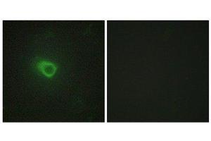 Immunofluorescence (IF) image for anti-Janus Kinase 1 (JAK1) (N-Term) antibody (ABIN1849256) (JAK1 Antikörper  (N-Term))