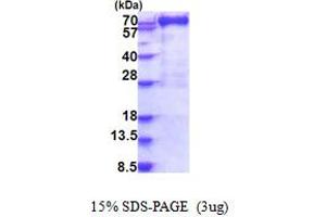SDS-PAGE (SDS) image for Myxovirus Resistance Protein 1 (MX1) (AA 1-662) protein (His tag) (ABIN5853896) (MX1 Protein (AA 1-662) (His tag))
