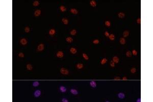 Immunofluorescence analysis of C6 cells using MYCT1 Polyclonal Antibody at dilution of 1:100. (Myc Target 1 Antikörper)