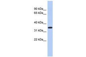 Image no. 1 for anti-Kruppel-Like Factor 6 (KLF6) (AA 71-120) antibody (ABIN6740430) (KLF6 Antikörper  (AA 71-120))