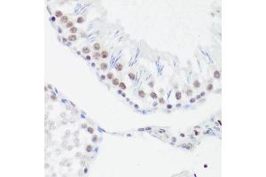 Immunohistochemistry (IHC) image for anti-Histone H4 (meArg3) antibody (ABIN1680264)