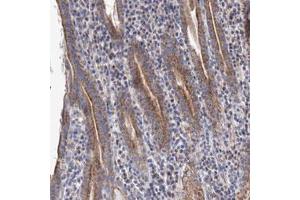 Immunohistochemical staining (Formalin-fixed paraffin-embedded sections) of human stomach with YARS2 polyclonal antibody  shows cytoplasmic positivity in glandular cells. (YARS2 Antikörper)