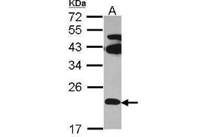 WB Image Sample (30 ug of whole cell lysate) A: Hela 12% SDS PAGE FAM18B antibody antibody diluted at 1:1000 (TVP23C/FAM18B2 Antikörper  (Internal Region))