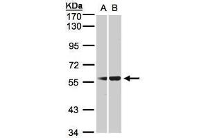 Western Blotting (WB) image for anti-Serpin Peptidase Inhibitor, Clade G (C1 Inhibitor), Member 1 (SERPING1) (Center) antibody (ABIN2856082)