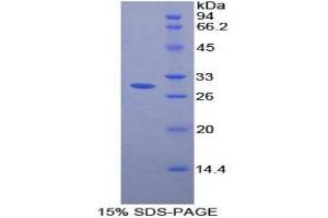 SDS-PAGE analysis of Rat FcgRII Protein.
