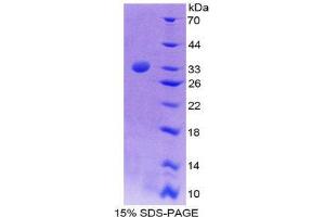 SDS-PAGE (SDS) image for REL proto-oncogene (c-Rel) (AA 93-353) protein (His tag) (ABIN1981253) (c-Rel Protein (AA 93-353) (His tag))