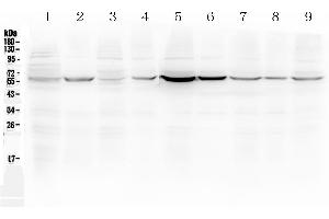 Western blot analysis of ESR2 using anti-ESR2 antibody . (ESR2 Antikörper  (AA 289-501))