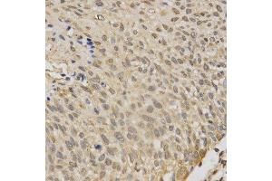 Immunohistochemistry (Paraffin-embedded Sections) (IHC (p)) image for anti-serine/threonine Kinase 11 (STK11) (AA 134-433) antibody (ABIN3022973)