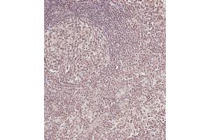 Immunohistochemical analysis of (ABIN6243102 and ABIN6578913) on paraffin-embedded Human tonsil tissue. (CDC25A Antikörper  (Ser124))
