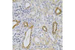 Immunohistochemistry (Paraffin-embedded Sections) (IHC (p)) image for anti-Keratin 20 (KRT20) (AA 245-424) antibody (ABIN3020782)