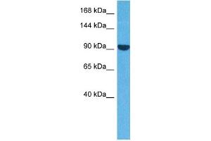Host:  Rabbit  Target Name:  ACTN3  Sample Tissue:  Human A549 Whole Cell  Antibody Dilution:  1ug/ml (ACTN3 Antikörper  (N-Term))