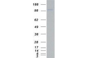 Western Blotting (WB) image for Unc-51 Like Kinase 1 (ULK1) protein (Myc-DYKDDDDK Tag) (ABIN2735006)