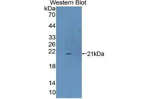 Western blot analysis of the recombinant protein. (Complexin 1 Antikörper  (AA 1-134))