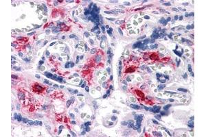 Immunohistochemical analysis of paraffin-embedded human Liver tissues using NKX3A antibody (NKX3-1 Antikörper)