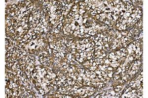 IHC analysis of DLAT using anti-DLAT antibody (ABIN7602307). (DLAT Antikörper  (AA 69-642))