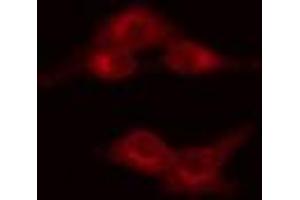 ABIN6269128 staining HeLa cells by IF/ICC. (MYB Antikörper  (C-Term))