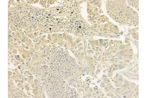 anti-Brain Protein I3 (BRI3) (N-Term) antibody