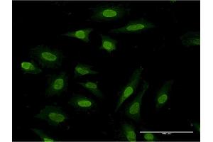 Immunofluorescence of monoclonal antibody to PDE3A on HeLa cell. (PDE3A Antikörper  (AA 533-640))