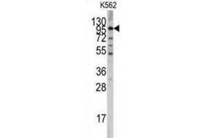Western Blotting (WB) image for anti-Leucine-Rich Repeat Containing G Protein-Coupled Receptor 5 (LGR5) antibody (ABIN3001607) (LGR5 Antikörper)
