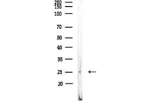 Western blot analysis of lysates from MCF7 cells(heat-shock,45 min treatment), using VTI1B Antibody at 1/1000 dilution.