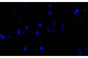 Immunofluorescence staining of 293F cells with ABIN7193151 at 1:100, counter-stained with DAPI. (HA-Tag Antikörper)