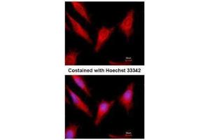 ICC/IF Image Immunofluorescence analysis of methanol-fixed HeLa, using Protein C, antibody at 1:500 dilution. (PROC Antikörper)