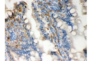 Anti- Galectin3 Picoband antibody, IHC(P) IHC(P): Rat Intestine Tissue (Galectin 3 Antikörper  (AA 153-264))