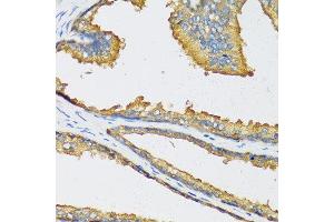 Immunohistochemistry of paraffin-embedded human prostate using CXCL11 antibody at dilution of 1:100 (40x lens). (CXCL11 Antikörper)