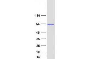 TMEM102 Protein (Myc-DYKDDDDK Tag)