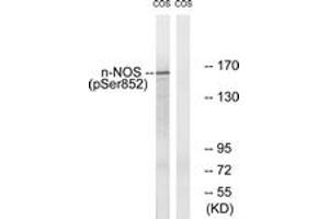 Western blot analysis of extracts from A549 cells, using n-NOS (Phospho-Ser852) Antibody. (NOS1 Antikörper  (pSer852))