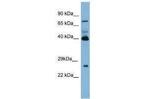 Transglutaminase 3 antibody used at 1 ug/ml to detect target protein. (TGM3 Antikörper)